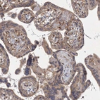 Immunohistochemical staining of human placenta shows moderate cytoplasmic positivity in trophoblastic cells.