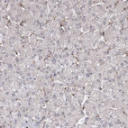Immunohistochemical staining of human liver shows no positivity in hepatocytes as expected.