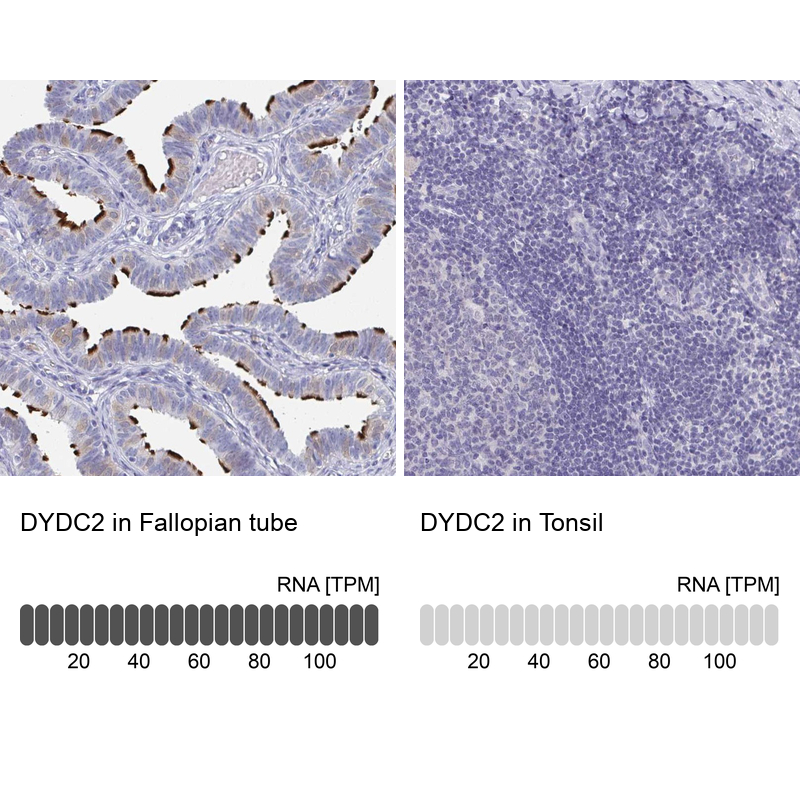 Anti-DYDC2 Antibody