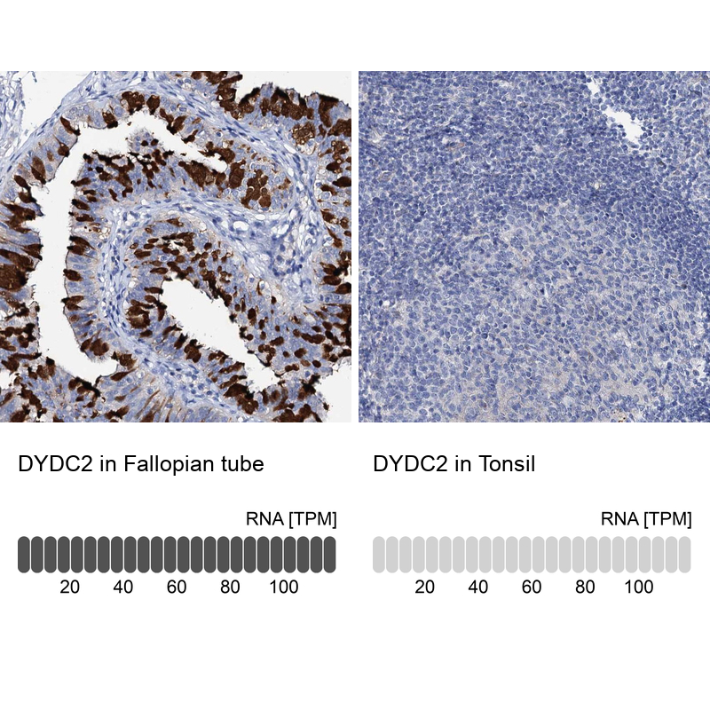 Anti-DYDC2 Antibody