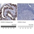 Anti-DYDC2 Antibody