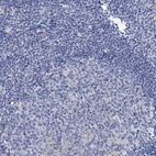 Anti-DYDC2 Antibody