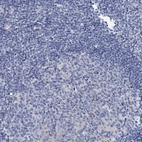 Immunohistochemical staining of human tonsil shows low expression as expected.