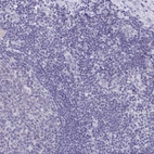Immunohistochemical staining of human tonsil shows low expression as expected.