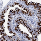 Immunohistochemical staining of human fallopian tube shows high expression.