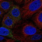 Immunofluorescent staining of human cell line CACO-2 shows localization to cytosol.