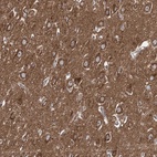 Anti-ADCY2 Antibody