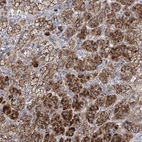 Anti-NME7 Antibody