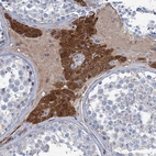 Immunohistochemical staining of human testis shows strong cytoplasmic positivity in Leydig cells.