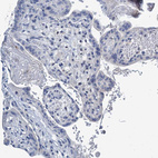 Immunohistochemical staining of human placenta shows no positivity in trophoblastic cells as expected.