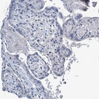 Immunohistochemical staining of human placenta shows no positivity in trophoblastic cells as expected.