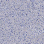 Immunohistochemical staining of human pancreas shows no positivity in exocrine glandular cells as expected.
