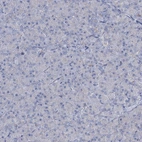 Immunohistochemical staining of human pancreas shows no positivity in exocrine glandular cells as expected.