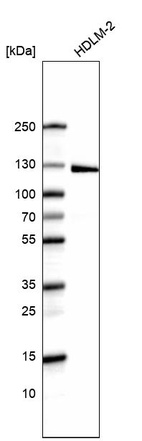 Western blot analysis in human cell line HDLM-2.