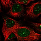 Immunofluorescent staining of human cell line U-2 OS shows localization to nucleus & nucleoli fibrillar center.