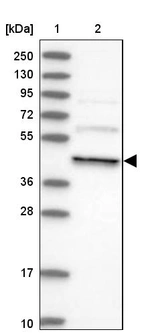 Lane 1: Marker [kDa] 250, 130, 95, 72, 55, 36, 28, 17, 10_br/_Lane 2: Human cell line RT-4