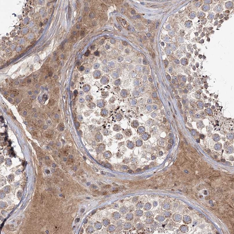 Anti-KIAA0825 Antibody