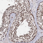 Anti-CFAP46 Antibody