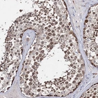 Anti-CFAP46 Antibody