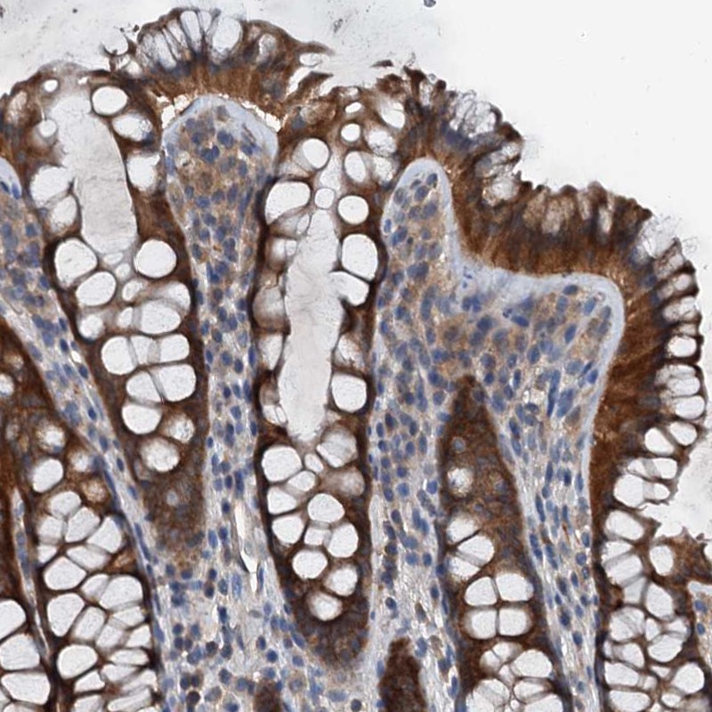 Anti-PDSS1 Antibody