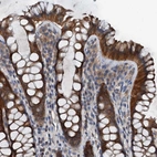 Anti-PDSS1 Antibody