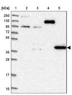 Lane 1: Marker [kDa] 250, 130, 95, 72, 55, 36, 28, 17, 10_br/_Lane 2: Human cell line RT-4_br/_Lane 3: Human cell line U-251MG sp_br/_Lane 4: Human plasma (IgG/HSA depleted)_br/_Lane 5: Human liver tissue
