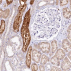 Anti-PTER Antibody