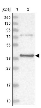 Lane 1: Marker [kDa] 250, 130, 95, 72, 55, 36, 28, 17, 10_br/_Lane 2: Human cell line RT-4