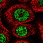 Immunofluorescent staining of human cell line A-431 shows localization to nucleoplasm.