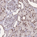 Anti-PRPF19 Antibody