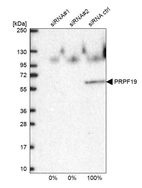Western blot analysis in U2OS cells transfected with control siRNA, target specific siRNA probe #1 and #2, using Anti-PRPF19 antibody. Remaining relative intensity is presented.