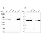 Western blot analysis using Anti-PRPF19 antibody HPA038051 (A) shows similar pattern to independent antibody HPA059070 (B).