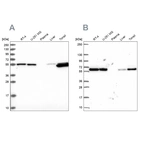 Western blot analysis using Anti-PRPF19 antibody HPA038051 (A) shows similar pattern to independent antibody HPA059070 (B).