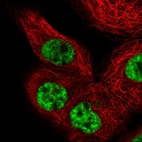 Immunofluorescent staining of human cell line A-431 shows localization to nuclear speckles.