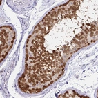 Immunohistochemical staining of human testis shows strong nuclear positivity in cells in seminiferous ducts.