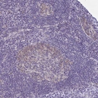 Immunohistochemical staining of human lymph node shows weak cytoplasmic positivity in germinal center cells.