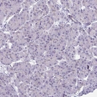 Immunohistochemical staining of human pancreas shows no positivity in exocrine glandular cells as expected.