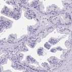 Immunohistochemical staining of human prostate shows no positivity in glandular cells as expected.