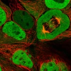 Immunofluorescent staining of human cell line CACO-2 shows localization to nucleoplasm & cytosol.