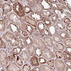 Anti-KIF14 Antibody