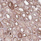 Anti-KIF14 Antibody