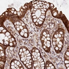 Immunohistochemical staining of human Rectum shows moderate cytoplasmic and membranous positivity in glandular cells.