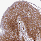 Immunohistochemical staining of human Skin shows moderate membranous and cytoplasmic positivity in squamous epithelial cells.