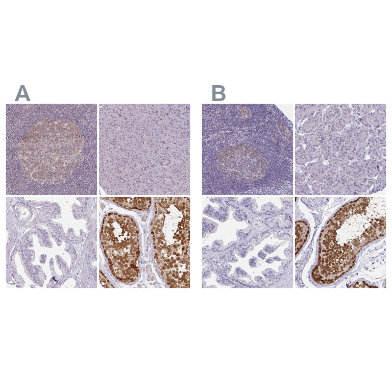 Anti-CSE1L Antibody