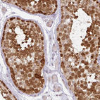 Immunohistochemical staining of human testis shows strong nuclear positivity in cells in seminiferous ducts.