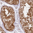 Immunohistochemical staining of human testis shows strong nuclear positivity in cells in seminiferous ducts.