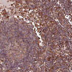 Immunohistochemical staining of human Lymph node shows moderate cytoplasmic positivity in germinal and non-germinal center cells.
