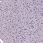 Immunohistochemical staining of human pancreas shows no positivity in exocrine glandular cells as expected.