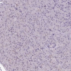 Immunohistochemical staining of human pancreas shows no positivity in exocrine glandular cells as expected.