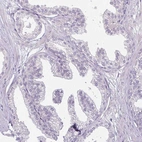 Immunohistochemical staining of human prostate shows no positivity in glandular cells as expected.